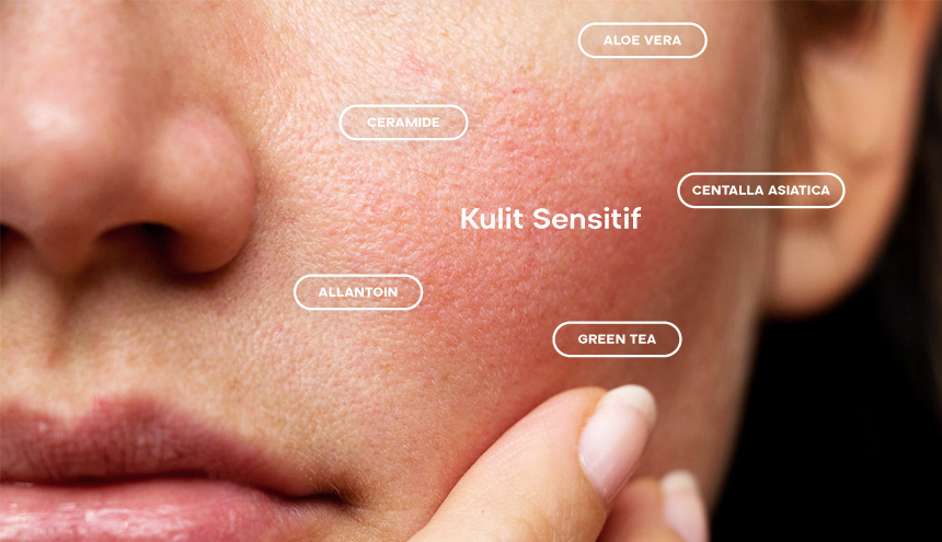 Beberapa Kandungan Skincare Terbaik untuk Kulit Sensitif, Ada Apa Saja?