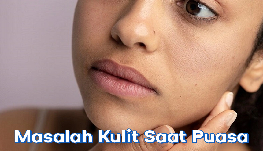 Begini Cara Atasi Masalah Kulit Saat Puasa, Mulai dari Kulit Kusam hingga Bibir Kering!