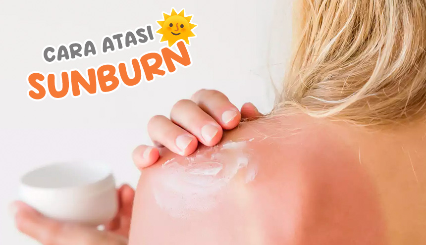 Kulit Sunburn? Jangan Panik! Ini Cara Cepat Mengatasinya