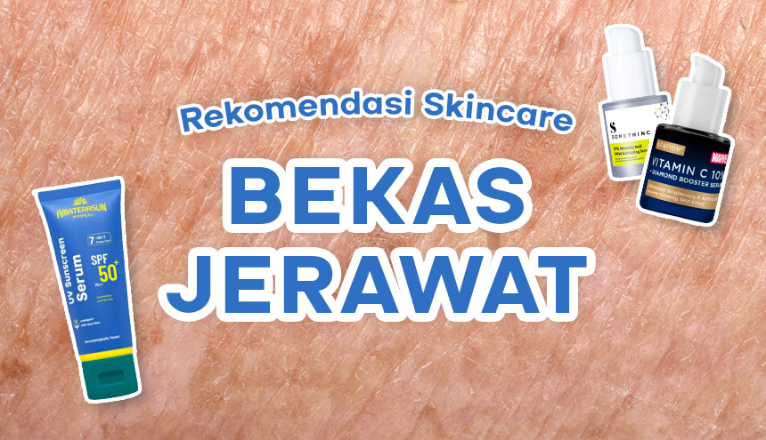 Rekomendasi Skincare Ekonomis untuk Atasi Noda Bekas Jerawat atau PIH