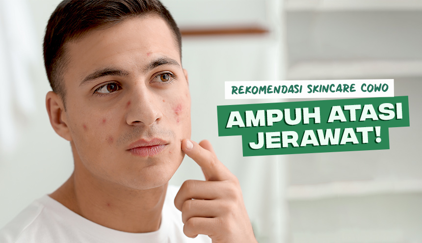 Viral! Ini 5 Rekomendasi Skincare Cowok untuk Atasi Jerawat