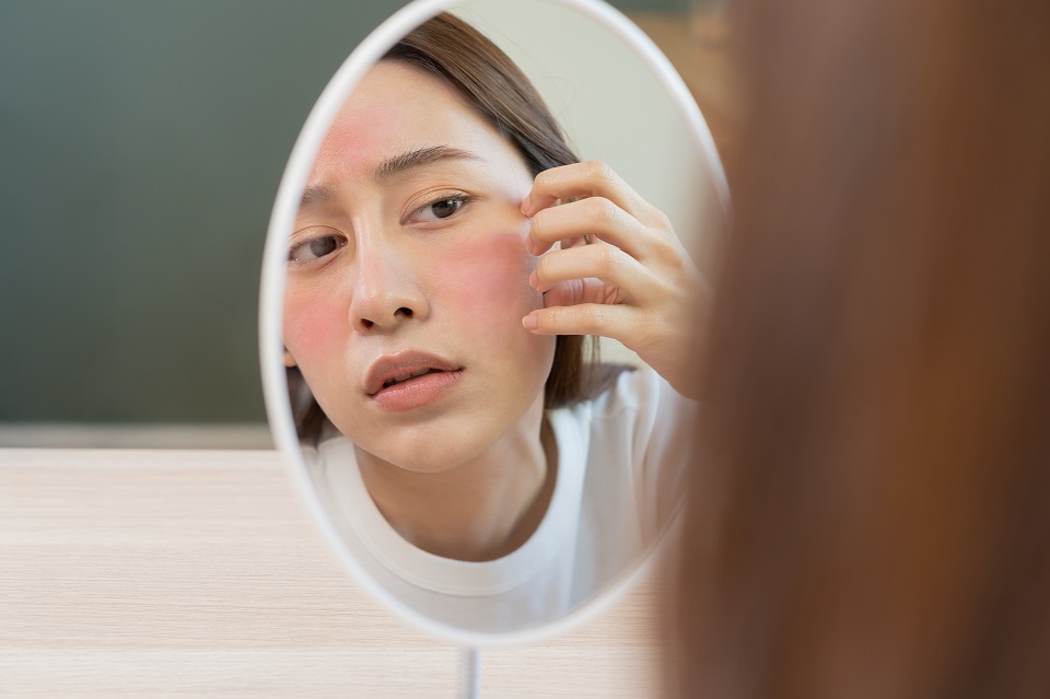 13 Cara Mengatasi Kulit Kering dan Kusam Supaya Kenyal dan Glowing